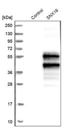 SNX16 Antibody in Western Blot (WB)