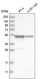 SH3GLB2 Antibody in Western Blot (WB)