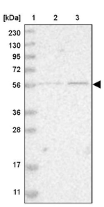 ZNF695 Antibody in Western Blot (WB)