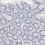 LY6D Antibody in Immunohistochemistry (IHC)