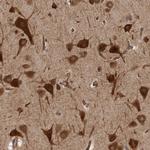 HOOK3 Polyclonal Antibody