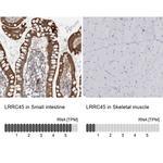 LRRC45 Antibody in Immunohistochemistry (IHC)