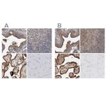 LRRC45 Polyclonal Antibody