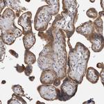 LRRC45 Antibody in Immunohistochemistry (IHC)