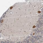 LRRC45 Antibody in Immunohistochemistry (IHC)
