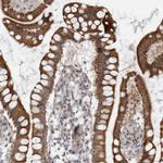 LRRC45 Antibody in Immunohistochemistry (IHC)