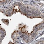 LRRC45 Antibody in Immunohistochemistry (IHC)