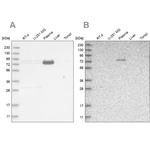 LRRC45 Antibody in Western Blot (WB)