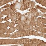 KLHL38 Polyclonal Antibody