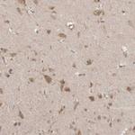 MICU3 Antibody in Immunohistochemistry (Paraffin) (IHC (P))