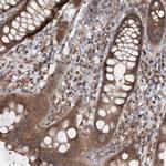 MICU3 Antibody in Immunohistochemistry (Paraffin) (IHC (P))