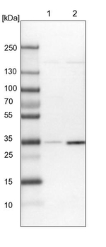 OTUD6B Antibody in Western Blot (WB)