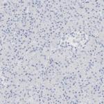 DPYS Antibody in Immunohistochemistry (IHC)