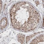 EXOSC4 Antibody in Immunohistochemistry (Paraffin) (IHC (P))