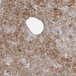 GEM Antibody in Immunohistochemistry (Paraffin) (IHC (P))
