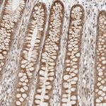 GEM Antibody in Immunohistochemistry (Paraffin) (IHC (P))