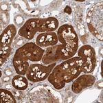 CTIF Polyclonal Antibody