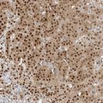 C8orf33 Antibody in Immunohistochemistry (Paraffin) (IHC (P))