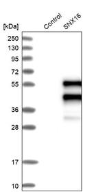 SNX16 Antibody in Western Blot (WB)