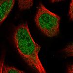 WDYHV1 Polyclonal Antibody