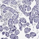 COL22A1 Antibody in Immunohistochemistry (Paraffin) (IHC (P))