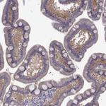 COL22A1 Polyclonal Antibody