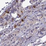 COL22A1 Antibody in Immunohistochemistry (IHC)
