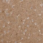 CUEDC1 Polyclonal Antibody