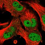 C17orf71 Polyclonal Antibody