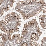 C17orf71 Antibody in Immunohistochemistry (Paraffin) (IHC (P))