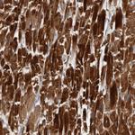 ZNF114 Antibody in Immunohistochemistry (Paraffin) (IHC (P))