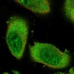 ZNF114 Polyclonal Antibody