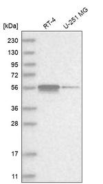 ZNF114 Antibody in Western Blot (WB)