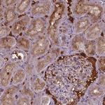 BTBD17 Polyclonal Antibody