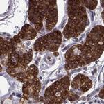 KIF13B Polyclonal Antibody