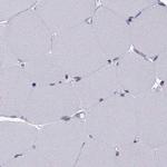 KIF13B Antibody in Immunohistochemistry (Paraffin) (IHC (P))