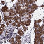 KIF13B Antibody in Immunohistochemistry (IHC)