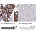 KIF13B Antibody