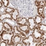 CNBD1 Polyclonal Antibody