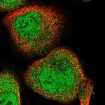 RAI16 Polyclonal Antibody