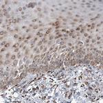 RAI16 Antibody in Immunohistochemistry (Paraffin) (IHC (P))