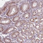 CCDC166 Polyclonal Antibody