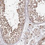 PHF20L1 Polyclonal Antibody