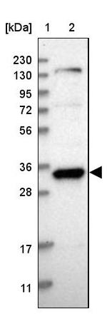 GTF2E2 Antibody in Western Blot (WB)