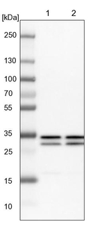 GTF2E2 Antibody in Western Blot (WB)