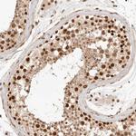 GTF2E2 Antibody in Immunohistochemistry (IHC)