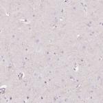 ERICH5 Antibody in Immunohistochemistry (IHC)