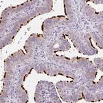 ERICH5 Antibody in Immunohistochemistry (IHC)