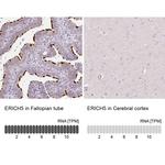 ERICH5 Antibody