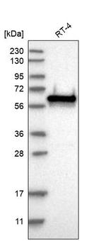 ERICH5 Antibody in Western Blot (WB)